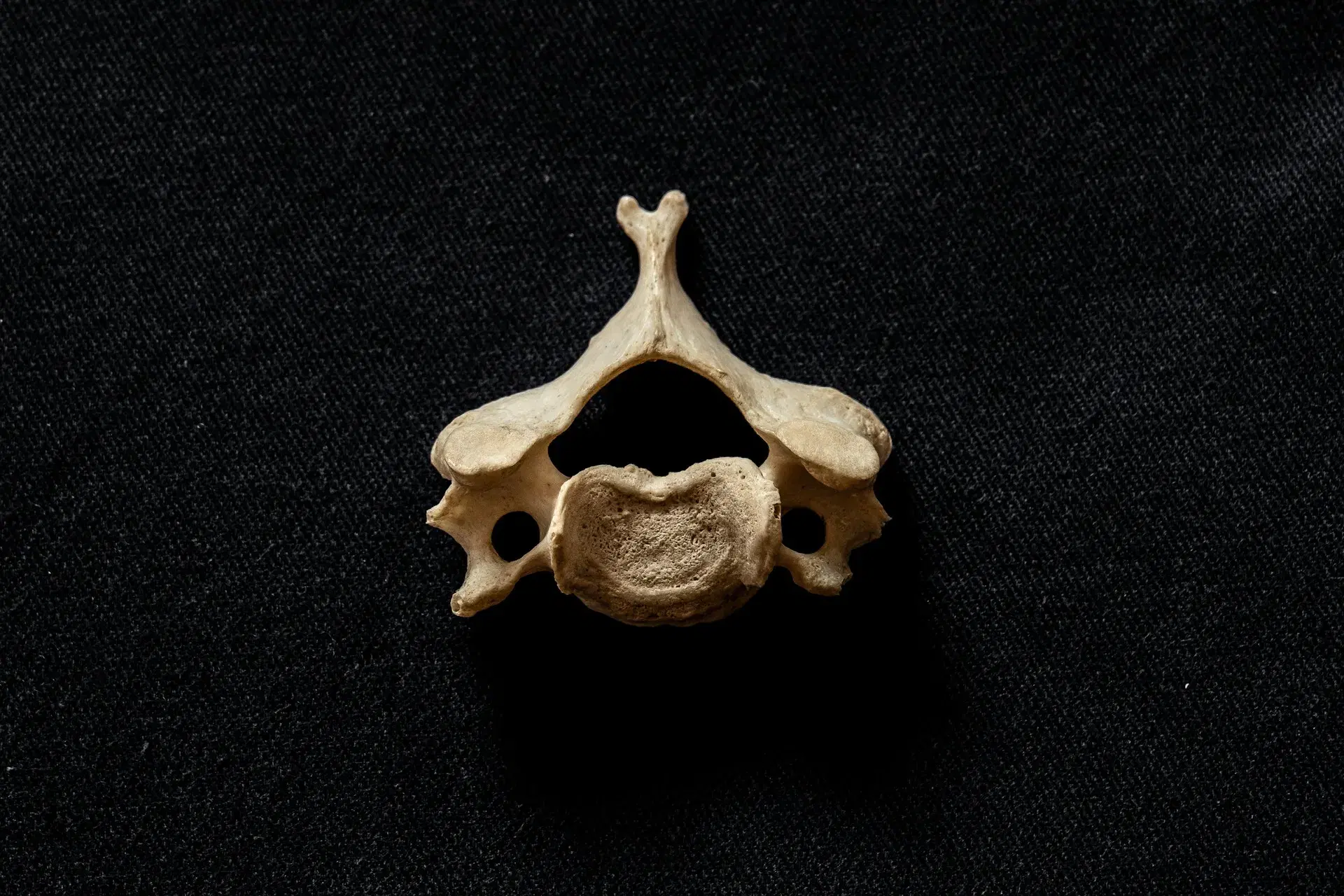 A single cervical vertebra photographed on black cloth, the vertebral canal open through the middle.