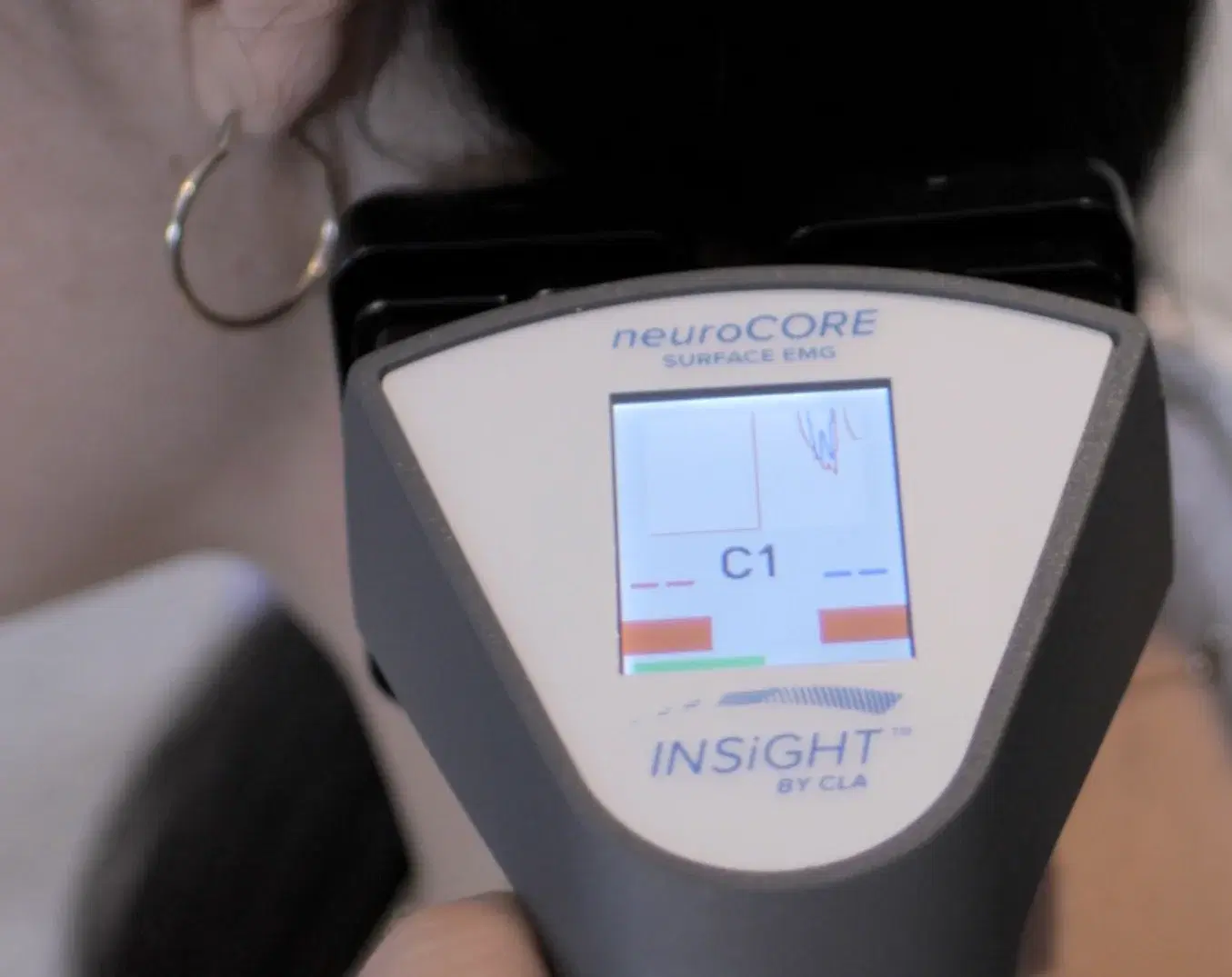 The NeuroCORE surface EMG unit reading a patient at the C1 level.